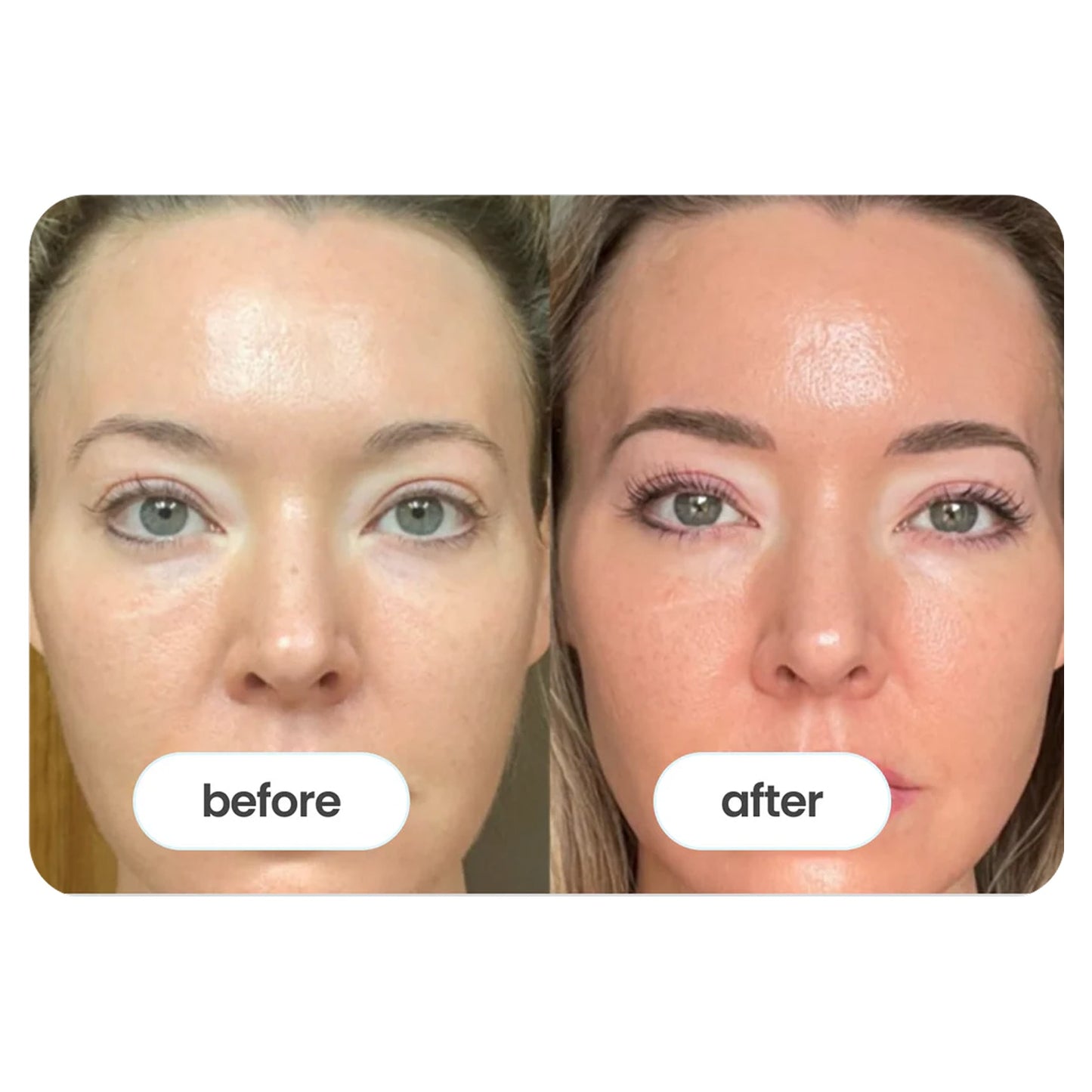 Vitality ↑® NAD+ Booster Powder (60g) for women over 33