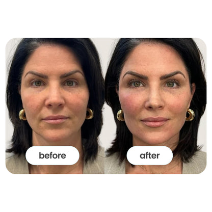 Vitality ↑® NAD+ Booster Powder (60g) for women over 33