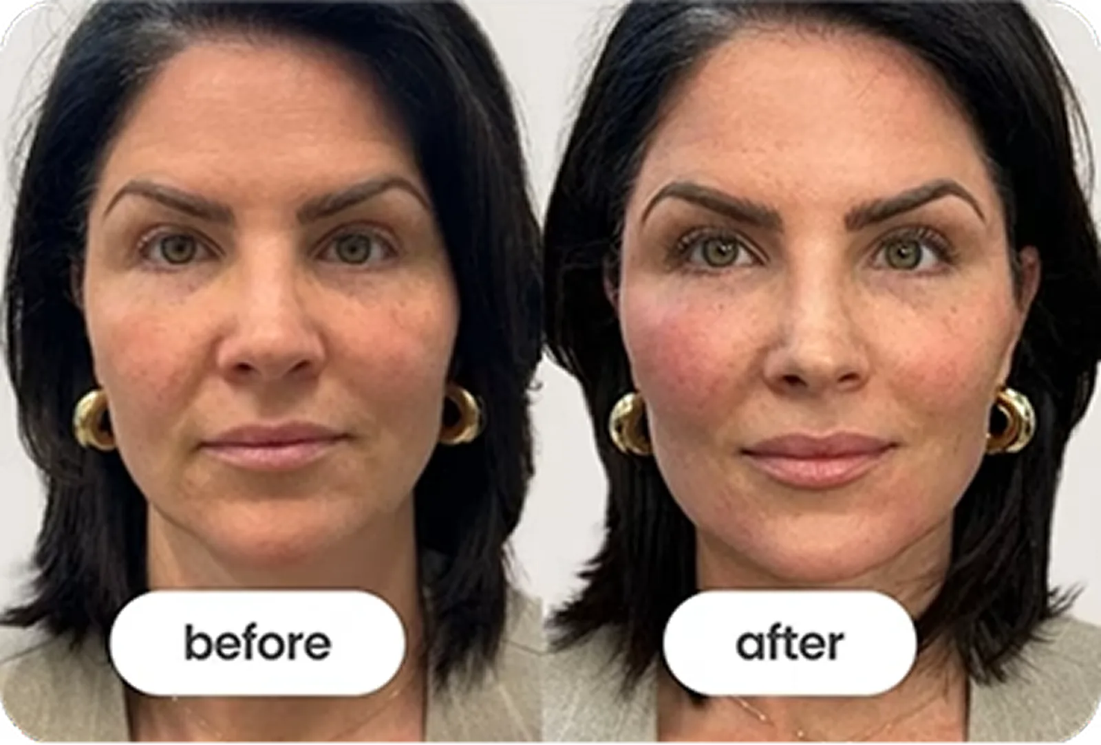 Menopause testimonial image 1 scaled c9fe93ec